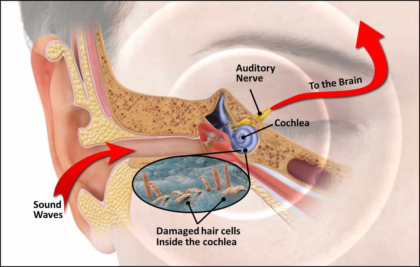 Age-Related Hearing Loss Is A Growing Problem | Bend, OR We Can Help