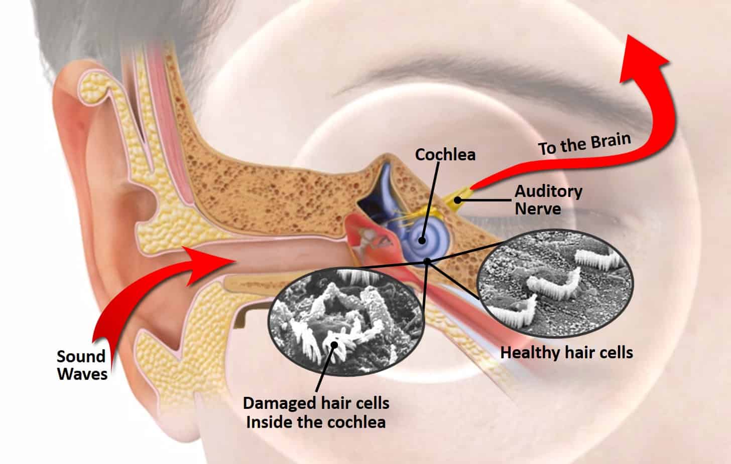 noise-induced-hearing-loss-our-bend-or-practice-will-help-you