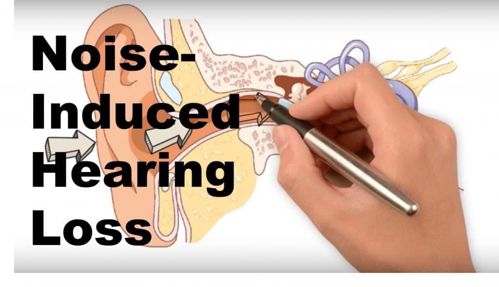 overview-of-hearing-loss-almostadoctor