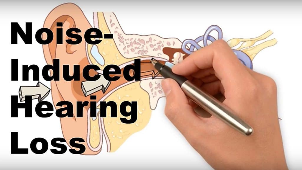 Noise Induced Hearing Loss Pacific Northwest Audiology 5949