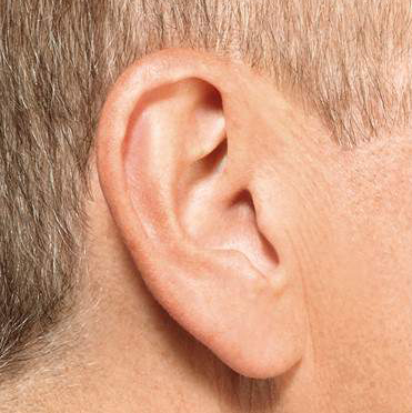IIC hearing aid